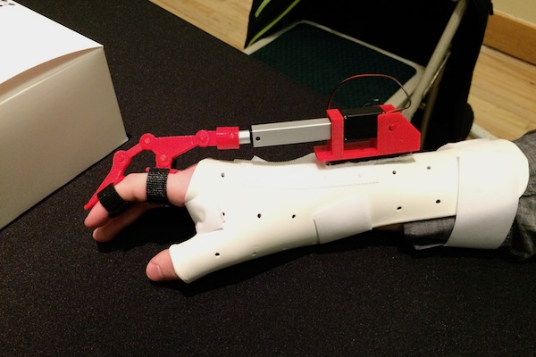 AccuGrip is a motorized gripping assistant for patients who cannot extend or flex their fingers. 