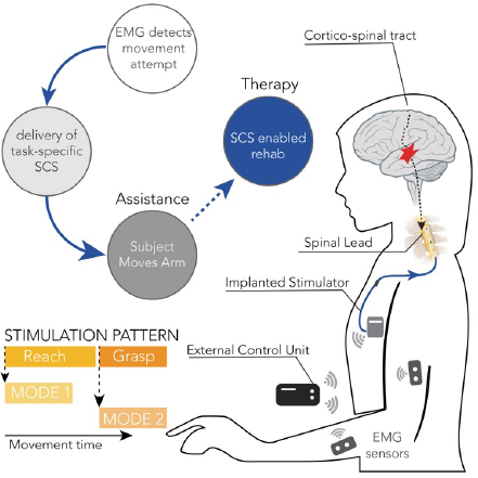schematic of spinal-cord stimulation for restoration or motor function